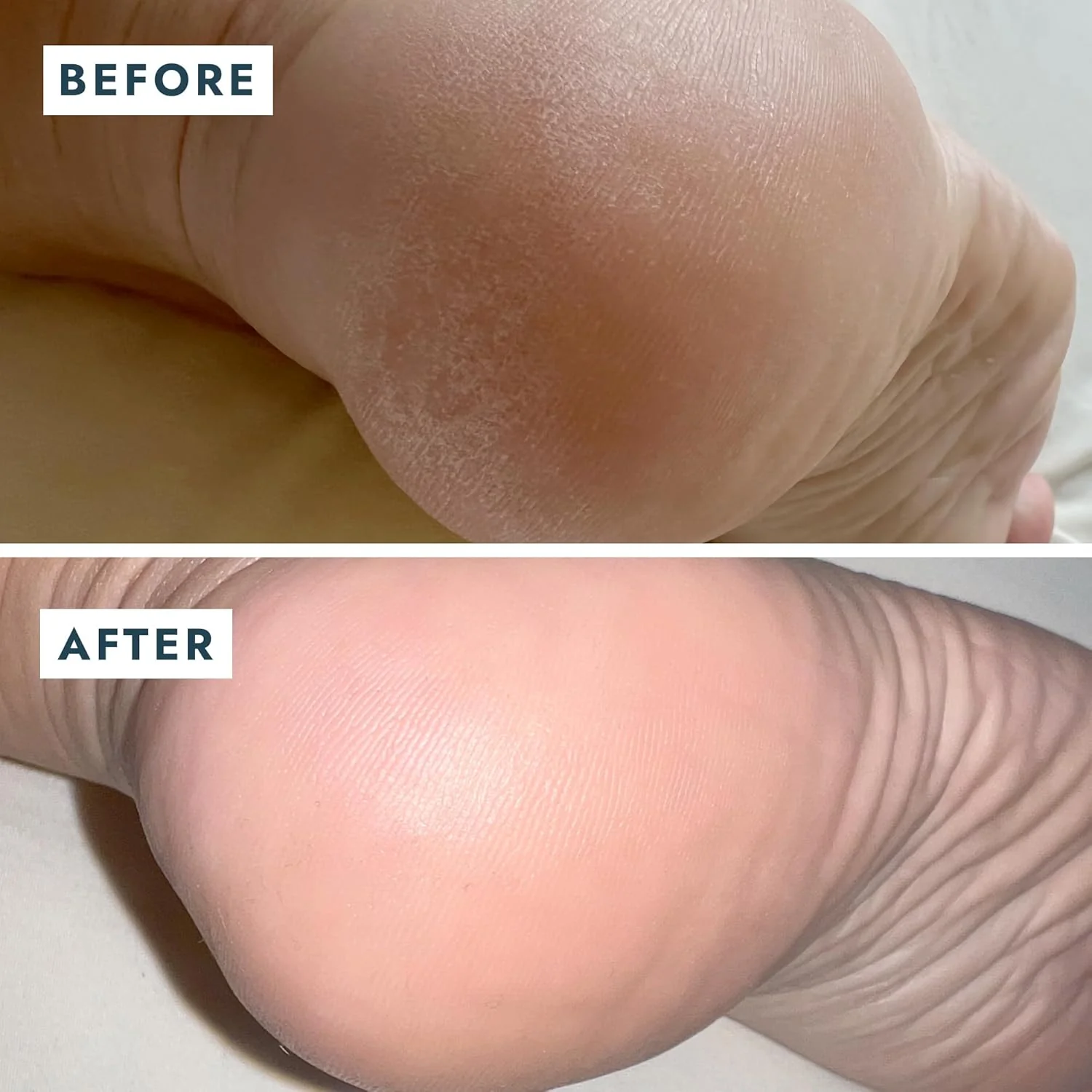 Voesh SoleMate Heel Repair Balm - Image 6